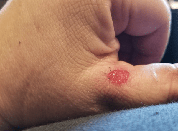 20180522.flower.garden.ouch